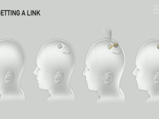 Neuralink宣布将进行首次人体试验，对瘫痪患者的大脑植入设备